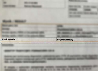 Mukowiscydoza – wszystko co chcesz wiedzieć, ale boisz się zapytać